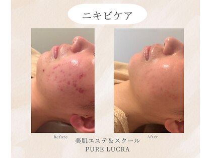 ピュアルクラ ＰＵＲＥ ＬＵＣＲＡの写真