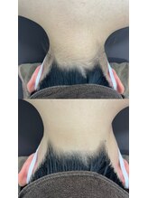 ミース 仙台長町店/うなじ矯正体験１回目！