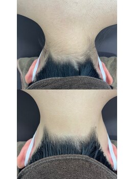 ミース 仙台長町店/うなじ矯正体験1回目!