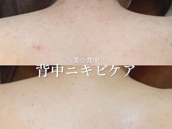 ルアナアイナ 大分/ハーブピーリング(8)