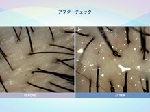 アンス(anth:)/お客様の仕上がり