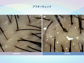 アンス(anth:)/お客様の仕上がり