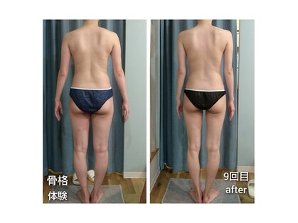 アクア(AQUA)の写真