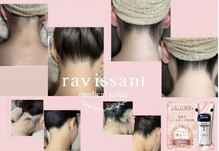 ラヴィソン(ravissant)