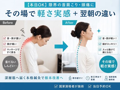 鍼灸ハリカラの写真