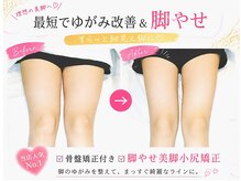 やまもと整骨院の雰囲気(このレベルの下半身痩せなら、平均3回ほどです。骨盤矯正付き!)