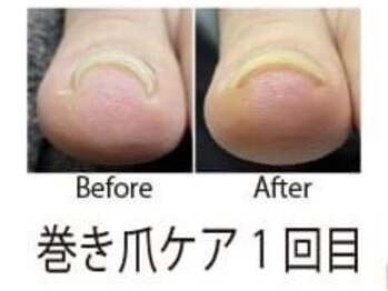 マムコレクション/フットケア