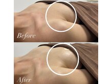 ブレスト サロン 奈良店(Bryst Salon)/バストアップ症例