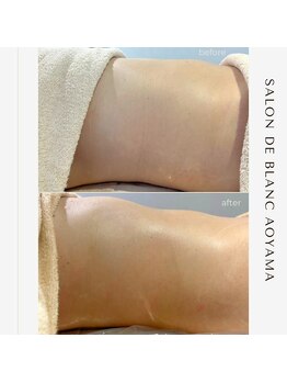 サロン ド ブラン アオヤマ(Salon de BLANC AOYAMA)/腸もみmassage