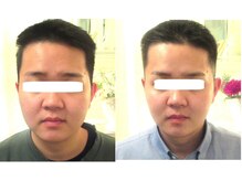 サロンドエステケイワイ(de KY)/フェイシャル☆小顔・たるみ改善