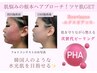【モニター様】 肌質改善・美肌目指す｜水光ピール 5回 ¥78,000→¥49,800