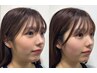 小顔矯正コルギ45分 ￥5980→￥4980