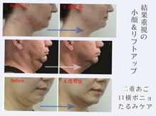 パリス 七尾店/世界50カ国で導入されている