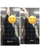 ナオル整体 センター南院(NAORU整体)/肩こりのBefore After
