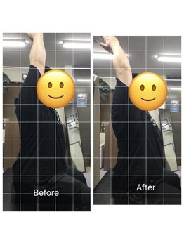 ナオル整体 センター南院(NAORU整体)/肩こりのBefore After