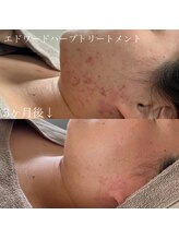 リュウ(le.lieu)/たったの3ヶ月