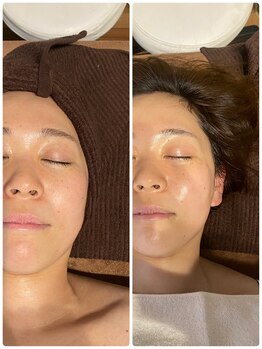 サンライズ(SUNRISE)/