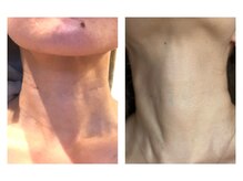 ヴィヴ コレビ(VIV COREBI)/深掘りしてた憎き首ライン