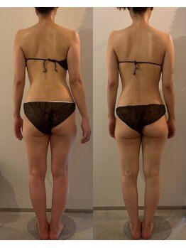 ラナ 京都西院店(Lana)/身体の歪み・腰痛改善