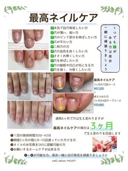 モストネイル 五日市店(MOST nail)/最高ネイルケア