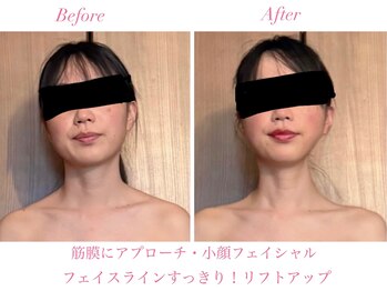 ラポーム 二子玉川(La paume)/深部リンパ・小顔フェイシャル