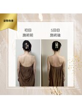 ロココ 町田店(Rococo)/5回で肩・背中スッキリ！