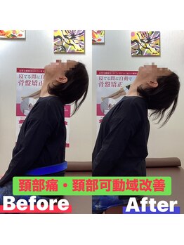 ヒデ整体院(Hide整体院)/猫背矯正骨盤矯正B/A肩こり腰痛