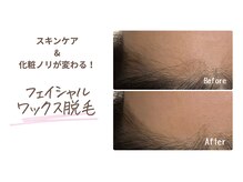 ルミエール(lumiere)/古い角質、産毛を一掃！