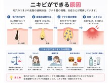 レア(Lea)/ニキビの根本的な理由を改善