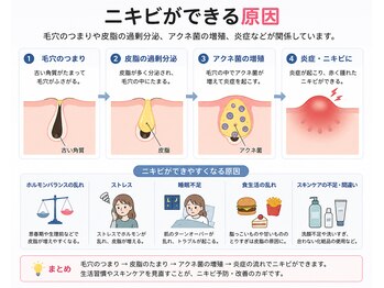 レア(Lea)/ニキビの根本的な理由を改善
