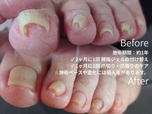 エンネイル(en.nail)の雰囲気（フット→巻き爪・爪切り・足裏角質ケア・タコ・ウオノメ）