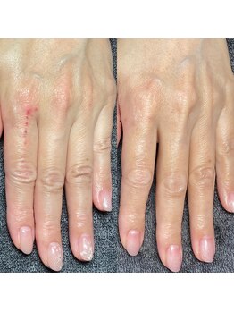 プラム(Plum)の写真/【40代・50代からのエイジングケアに】ハンドトリートメントで手・肌の潤いを整え、若々しい印象の指先へ♪