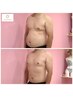男性【猫背・巻き肩】姿勢・骨格を整えるボディケア60分 ¥7,500