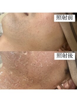 テンパ ビューティー(+10%beauty)/効果写真