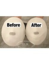 美極 銀座店/銀座/小顔コルギ/小顔矯正