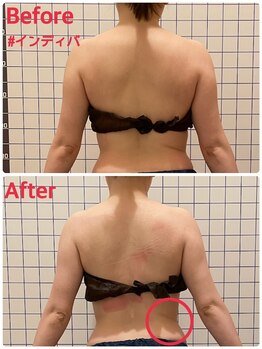 ソレイユ/首肩こり・歪み改善