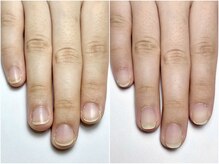 サロン アンド ルクス(Salon & Lux)/自爪育成