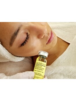 小顔になりたい