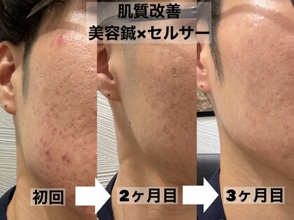 ソラナ(Solana)の写真