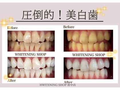 ホワイトニングショップ 府中店の写真