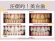 ホワイトニングショップ 府中店の写真