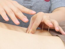 ワセダクラブ接骨院 鍼灸マッサージ院/鍼灸