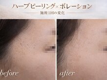 ビューティーサロン プティ(beauty salon petite)