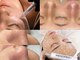 エトレ(ETOLE)の写真/★SNS話題★エステ版ポテンツァ☆スキンジェクションプ口!肌タイプに合わせて美容液を奥まで浸透◎
