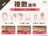 【術後ケア】インディバ90分◆腫れ/内出血/固さ ダウンタイムケア ￥17000→
