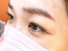 デイズ アイ ベクシー(Day`s eye Becsy)/3ヶ月の変化