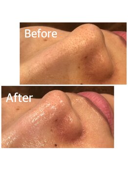 フォーケア(4Care)/ハイドロスキン