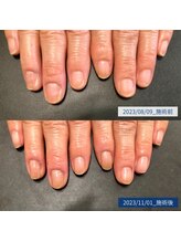 ブラン(blanc)/5.自爪育成