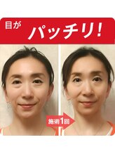 こんだ整骨院/小顔矯正☆ビフォーアフター
