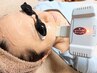 ＼不安要素なし／肌が弱い方必見【お顔全体美肌脱毛】感動の仕上がり♪